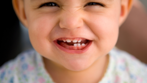 Vitamin D Could Slash Tooth Decay Risk by 50%, New Study Suggests