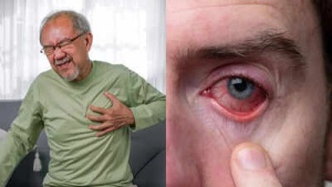 Heart Attack's Hidden Impact: Research Links Cardiac Events to Vision Loss Risk