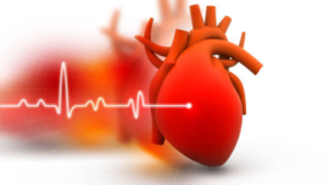 Mayo Clinic Study: Hidden Heart Attack Causes Revealed in Younger Women Beyond Clogged Arteries