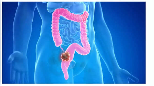 Sudden Weight Loss: A Symptom Not to Ignore