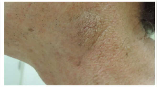 Itchy skin illustrated in an image.