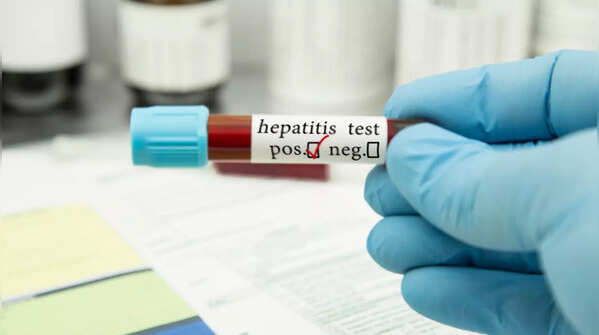 What is hepatitis E