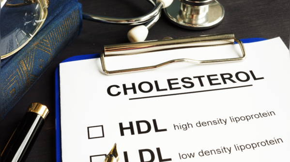 Two different worlds: Blood vs brain cholesterol