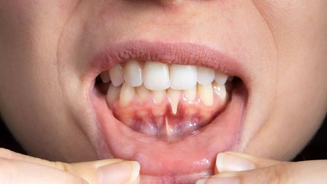 Benefits of peppermint oil for oral health
